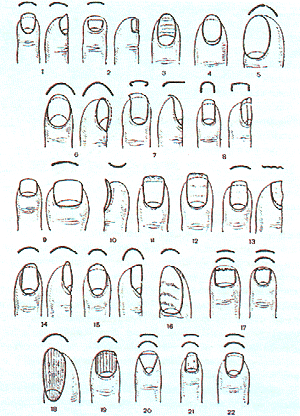 О каких болезнях можно узнать по ногтям